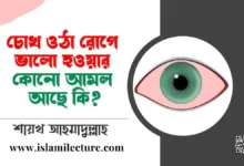 চোখ ওঠা রোগের জন্য কোনো আমল আছে কি - Islami Lecture