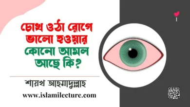 চোখ ওঠা রোগের জন্য কোনো আমল আছে কি - Islami Lecture